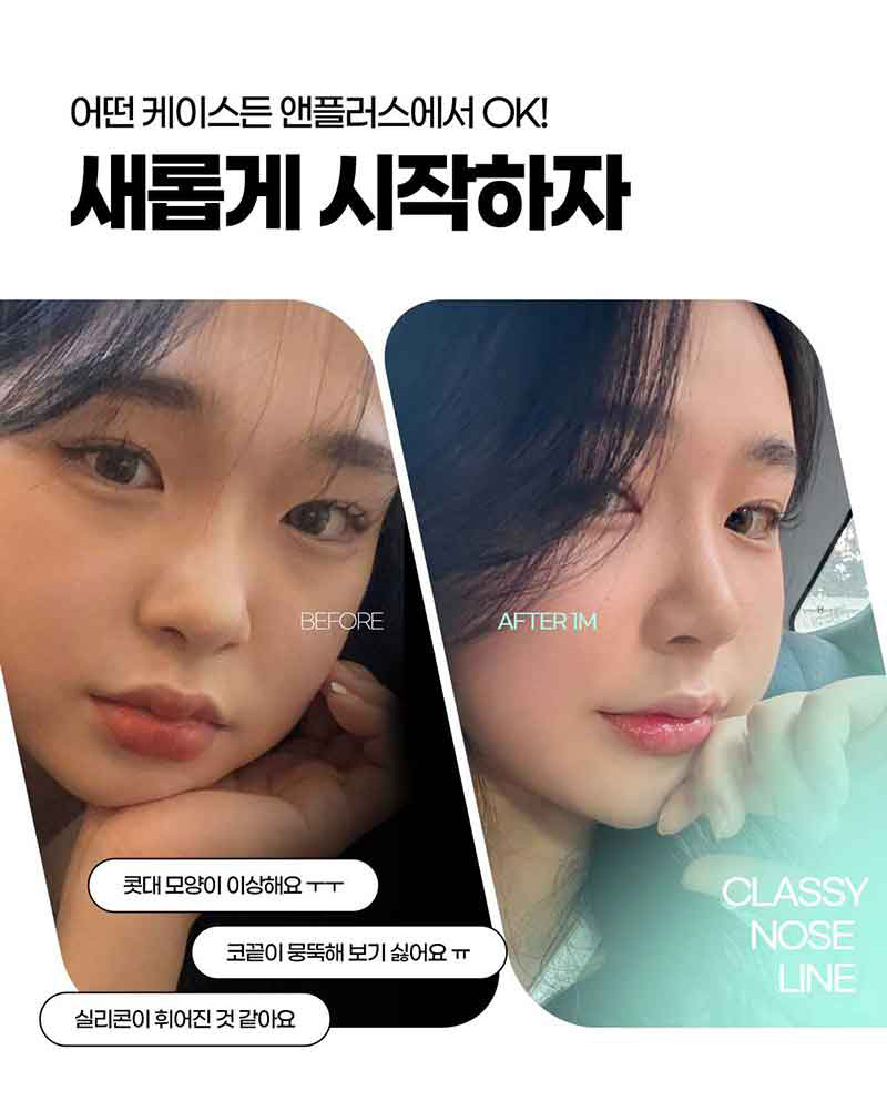 코실리콘제거를 통한 불편함 해소 관련 이미지 5