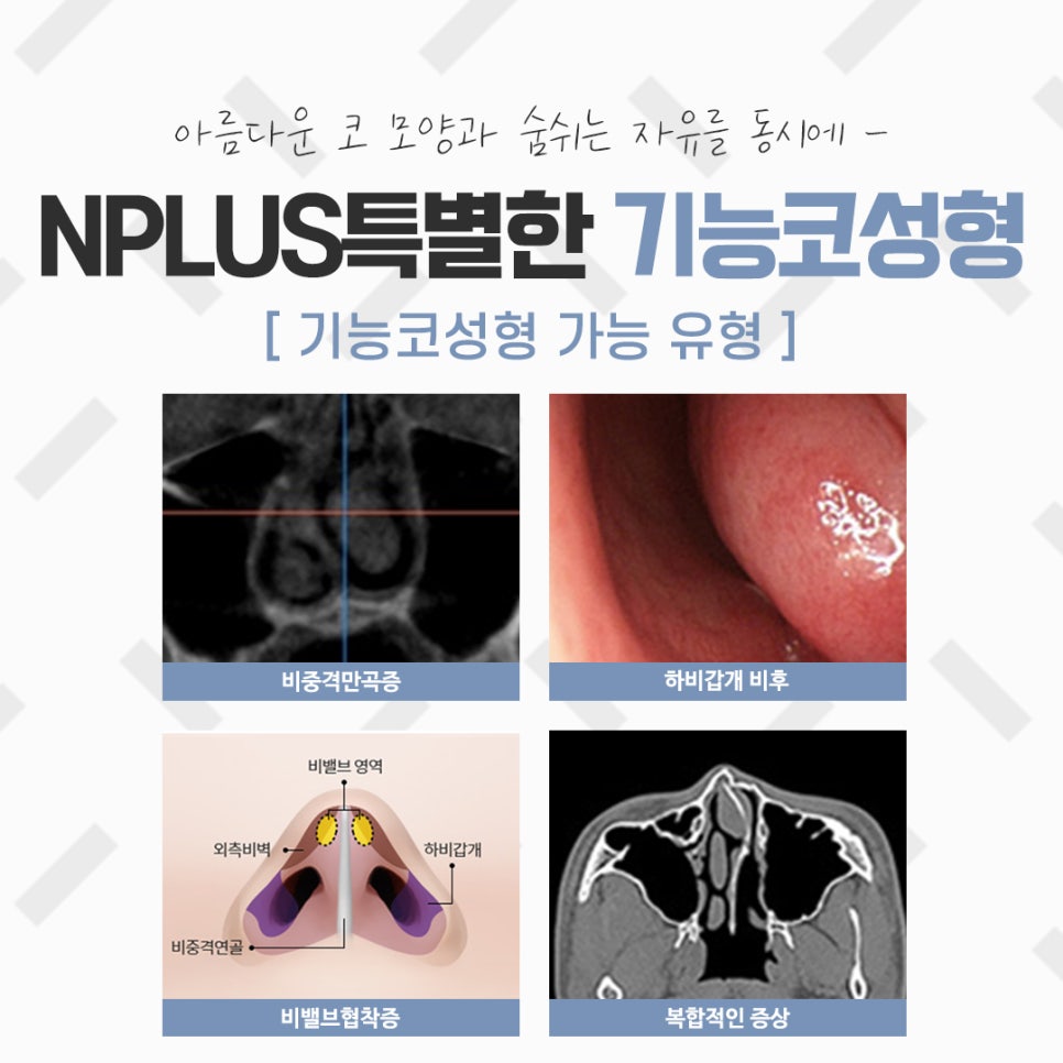 The Importance of Choosing Coverage for Nose Surgery image 4