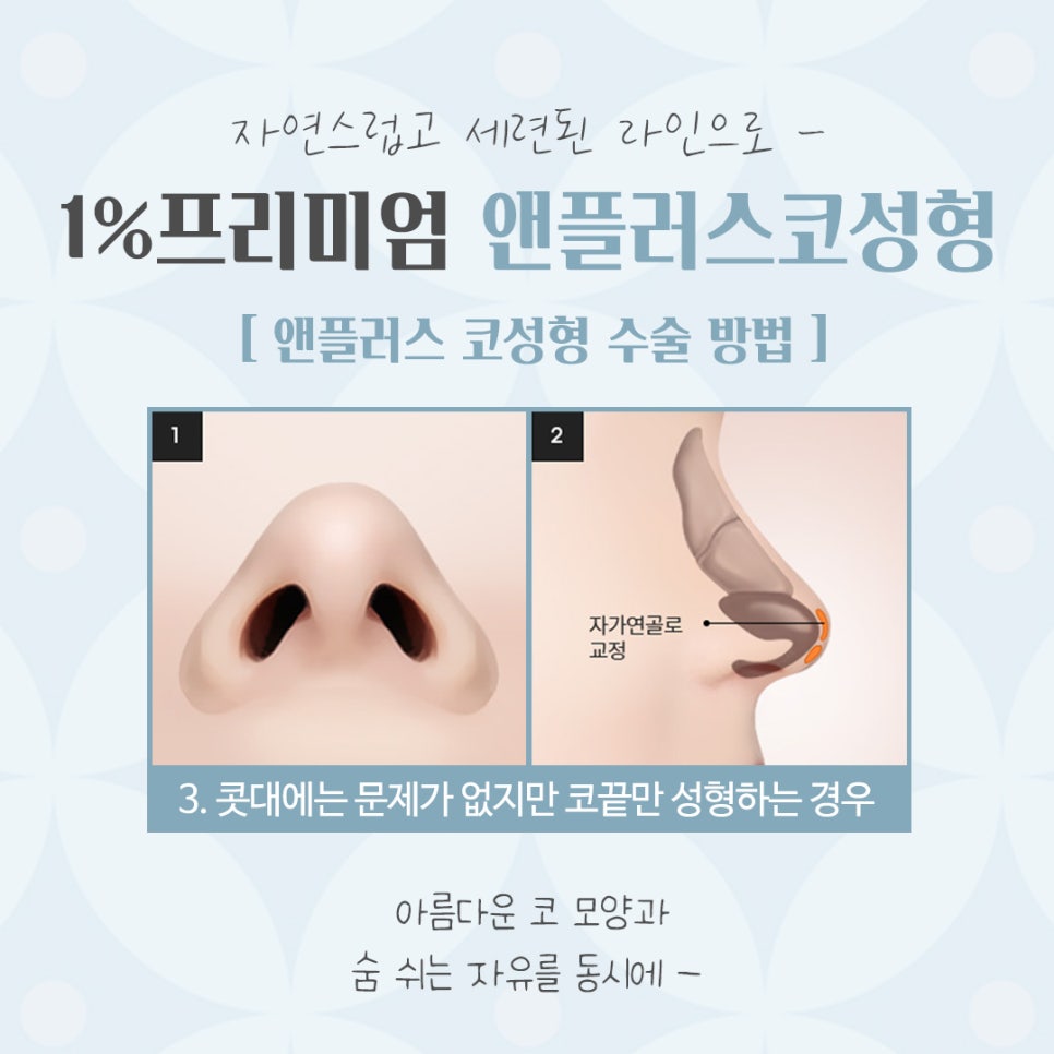 늑연골코수술 내용을 확인해 보고 관련 이미지 11