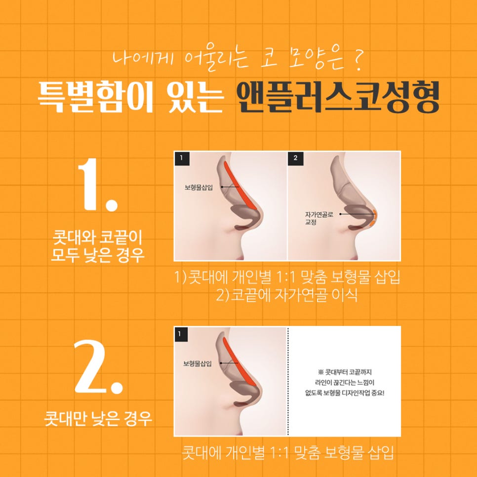 Nasal Bridge Surgery That Also Improved Rhinitis image 7