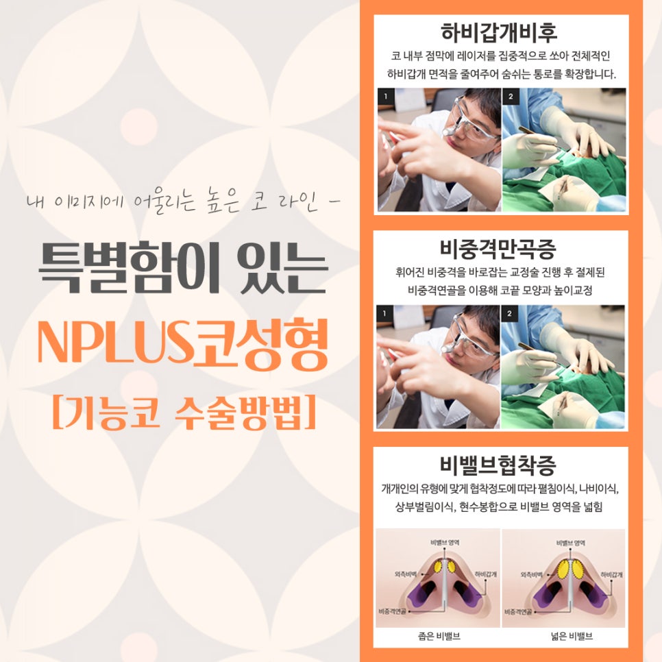 코성형잘하는병원 다양하게 알아보고 관련 이미지 8