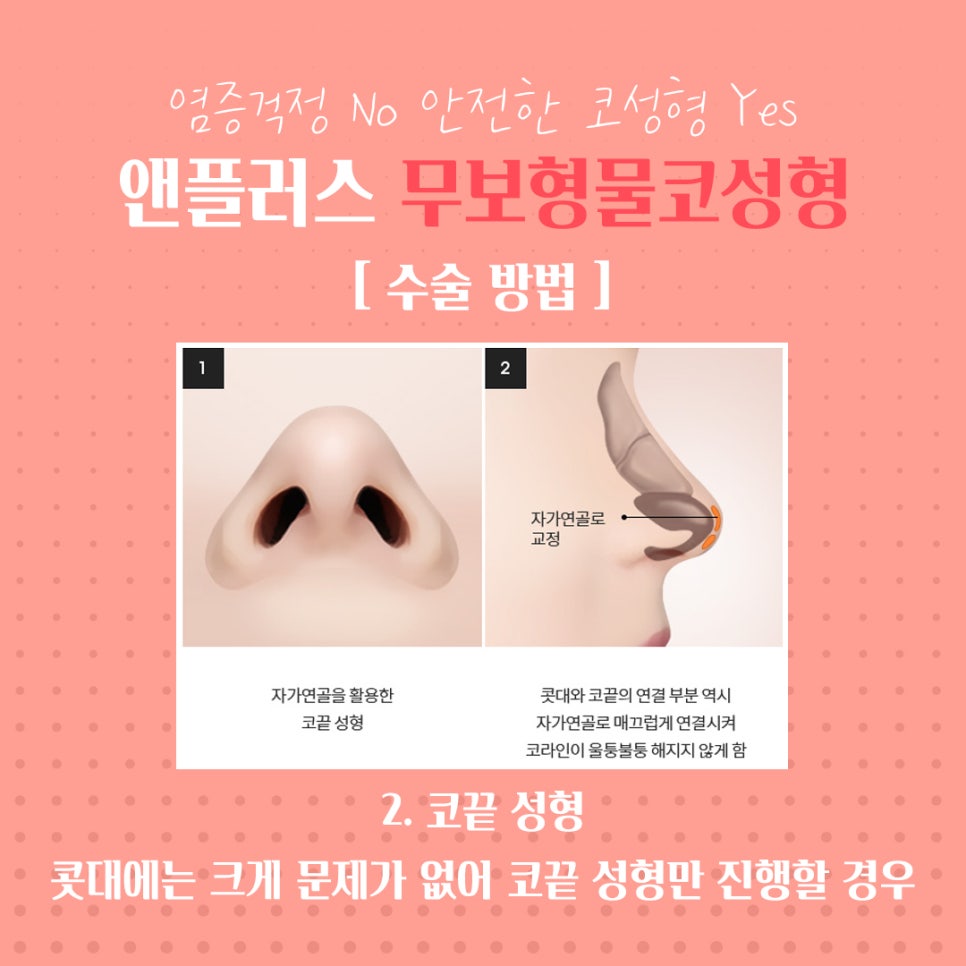 무보형물코수술 안전하고 자연스럽게 관련 이미지 7