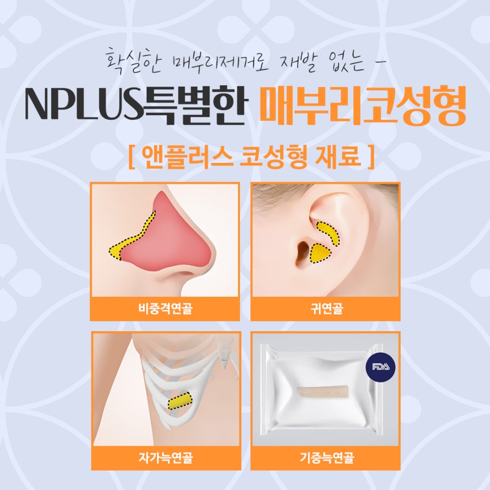 매부리코성형후기 매부리코 잘하는 곳에서 관련 이미지 13