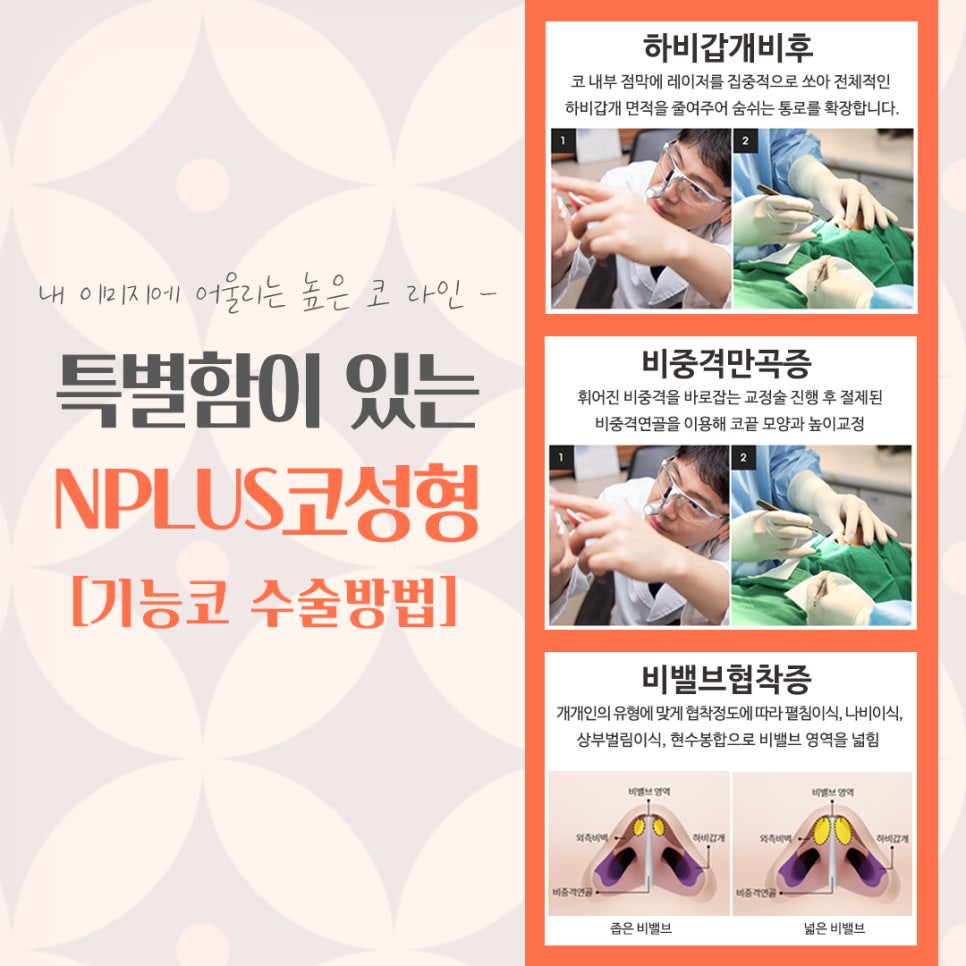 코성형잘하는병원의 차이를 알아보고 관련 이미지 10