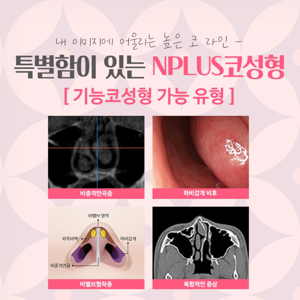 서울코수술잘하는곳 꼼꼼하게 알아보고 관련 이미지 4