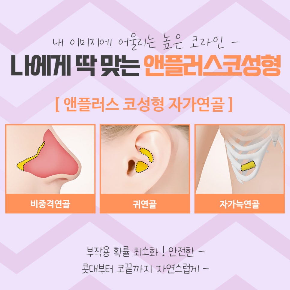 코수술후기 코 내부까지 확실하게 알아보고 관련 이미지 12