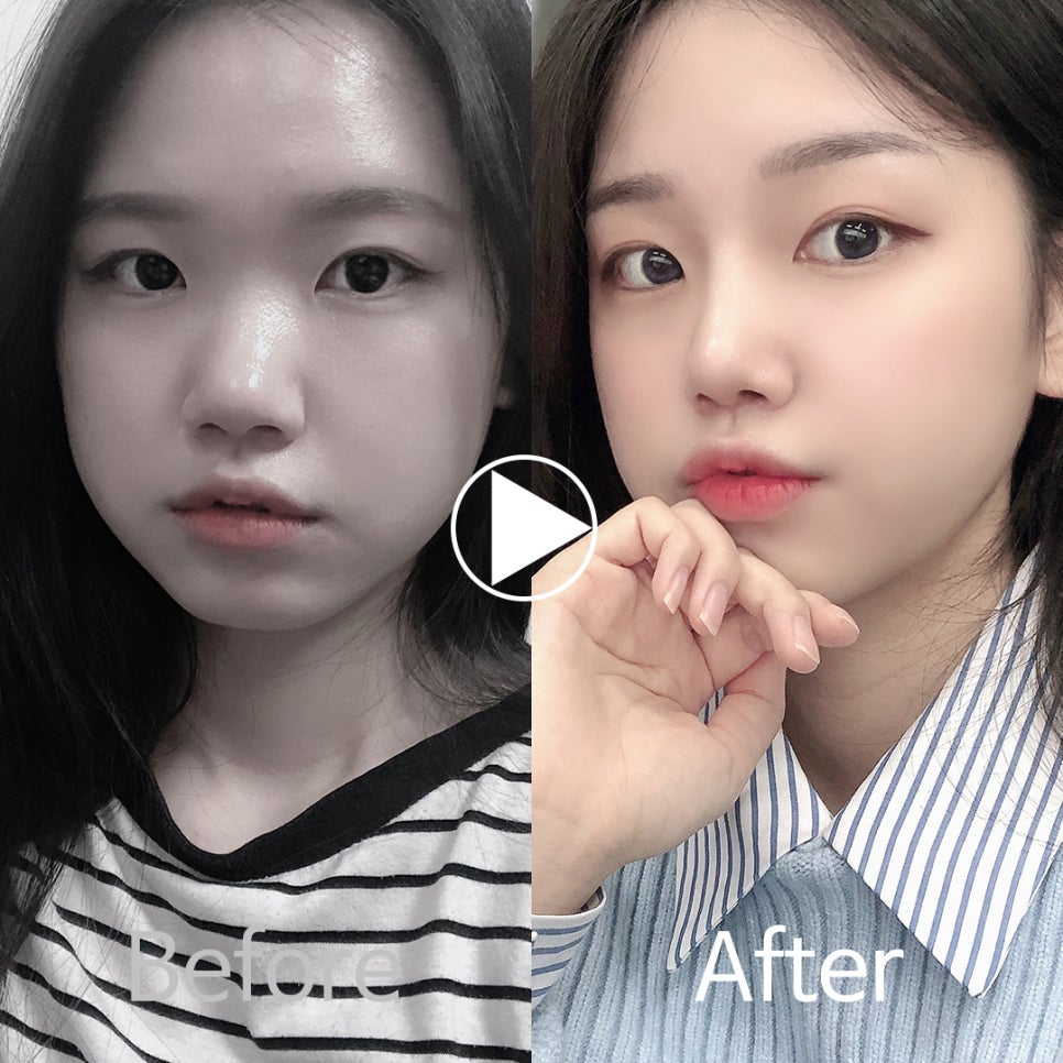 🎀앤플러스 코성형 모델모집🎀 관련 이미지 8