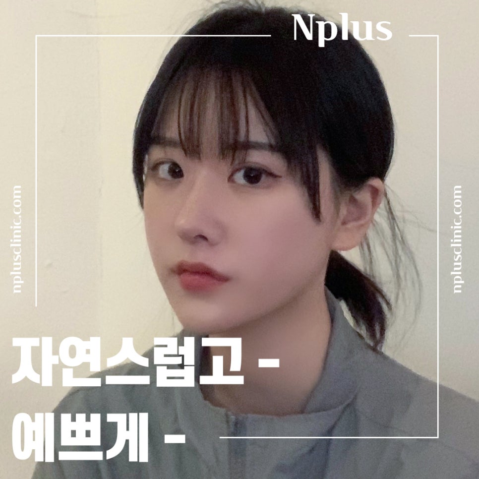 콧볼축소후기 퍼진코에 변화를 관련 이미지 9