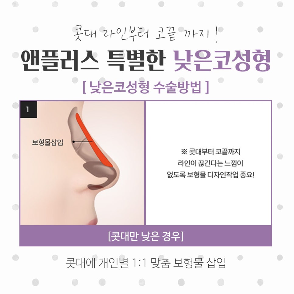 Checking Low Nose Surgery Reviews Too image 9