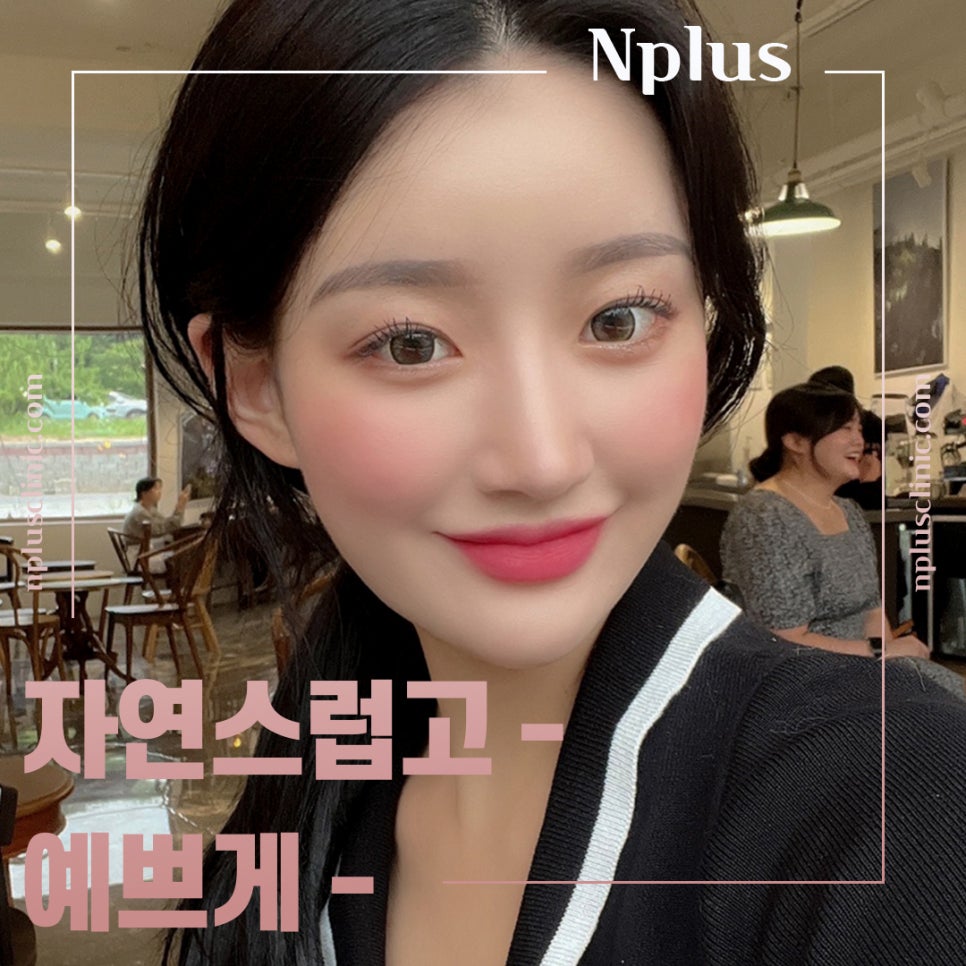 A Refined Look After Reviewing Upturned Nose Surgery Results image 3