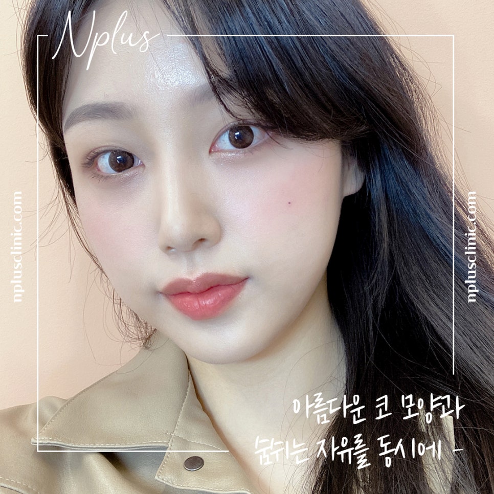 콧볼축소수술후기 내게 어울리는 라인으로 관련 이미지 2