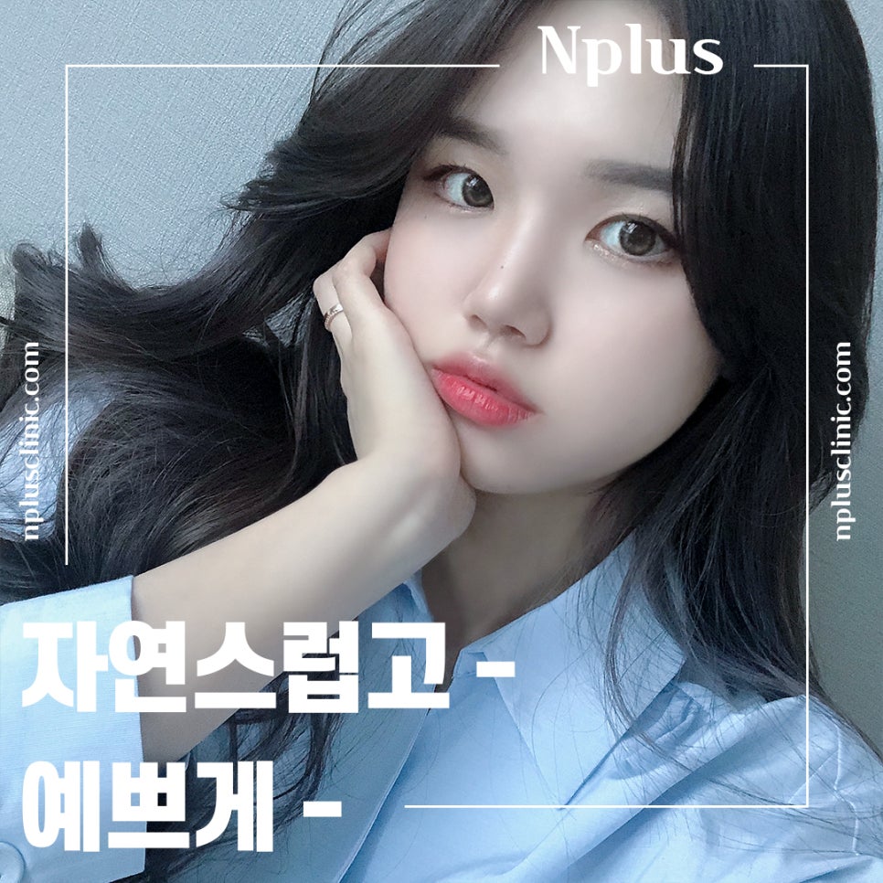 Rhinoplasty Review: Improved with a Refined Line image 1