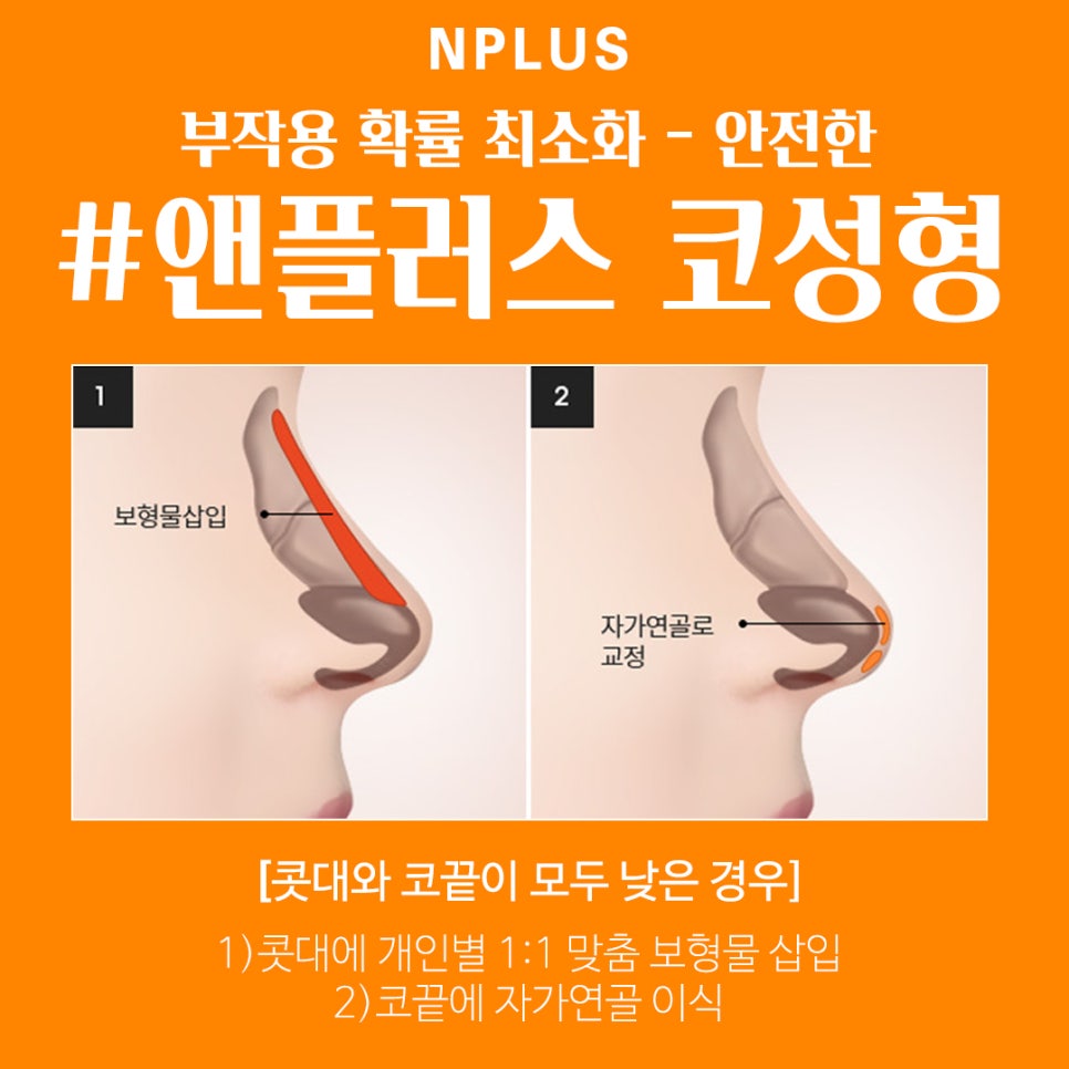 Increased Confidence with Low Nose Surgery image 4
