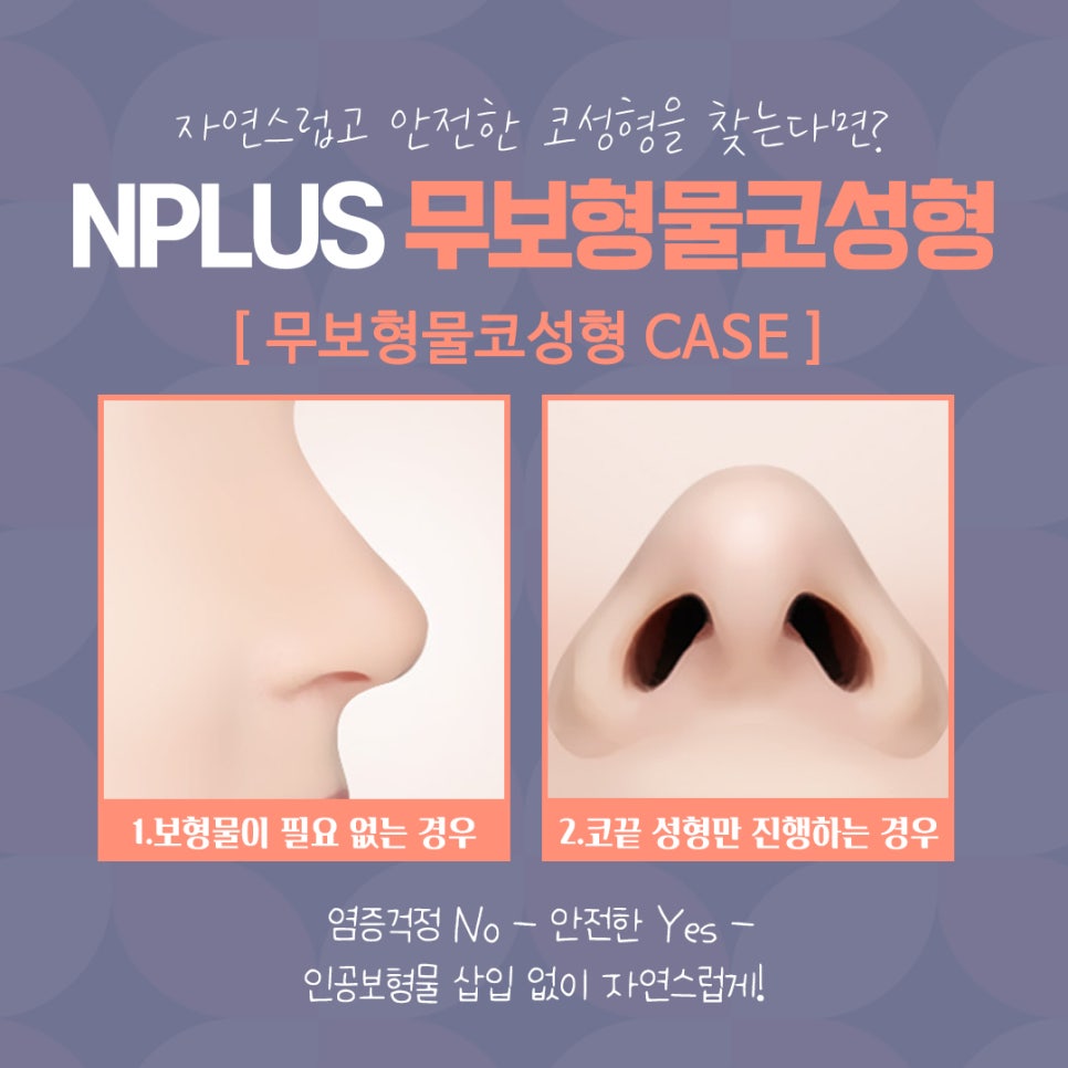무보형물코수술 자연스러운 코 라인을 원한다면! 관련 이미지 4