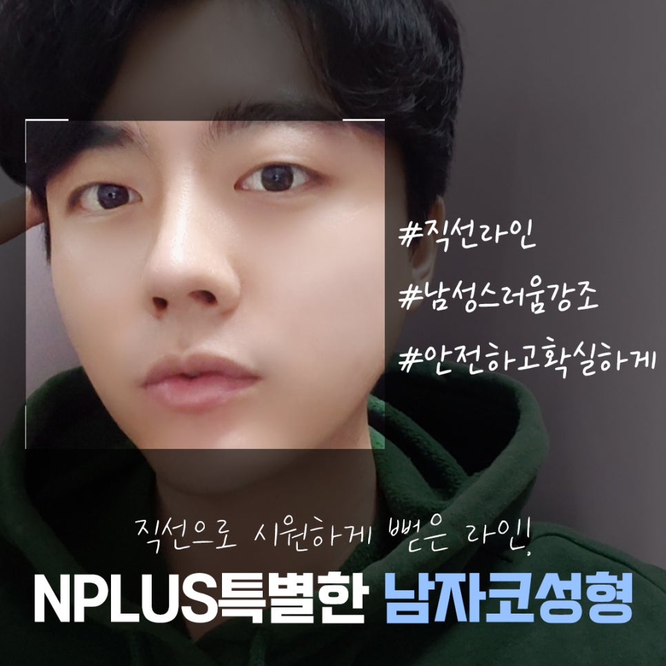 Male Nose Surgery Review: You Should Also Look into Function image 2