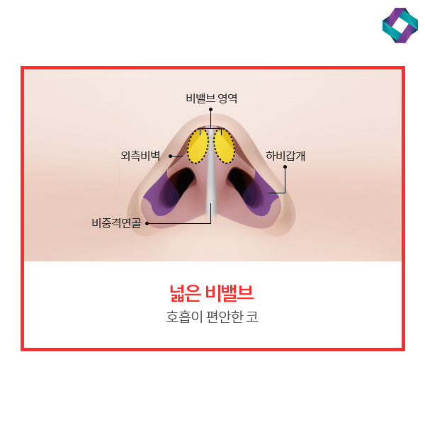 비염수술코성형 비밸브 교정술! 관련 이미지 4