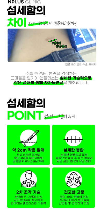 앤플러스에서 진행하는 기능코성형 EVENT 관련 이미지 7