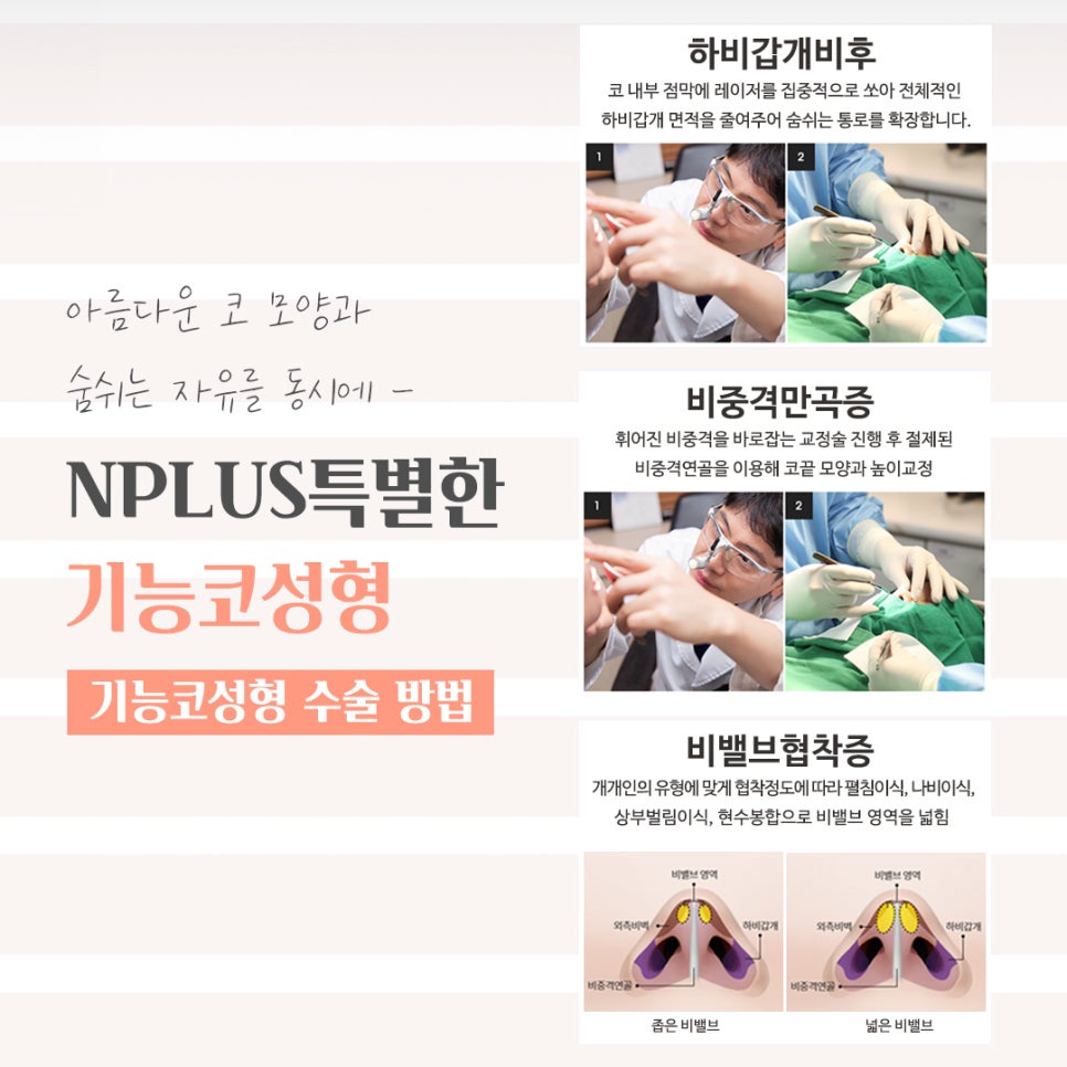 기능코성형후기에 대해 상세히 알아보고 관련 이미지 9