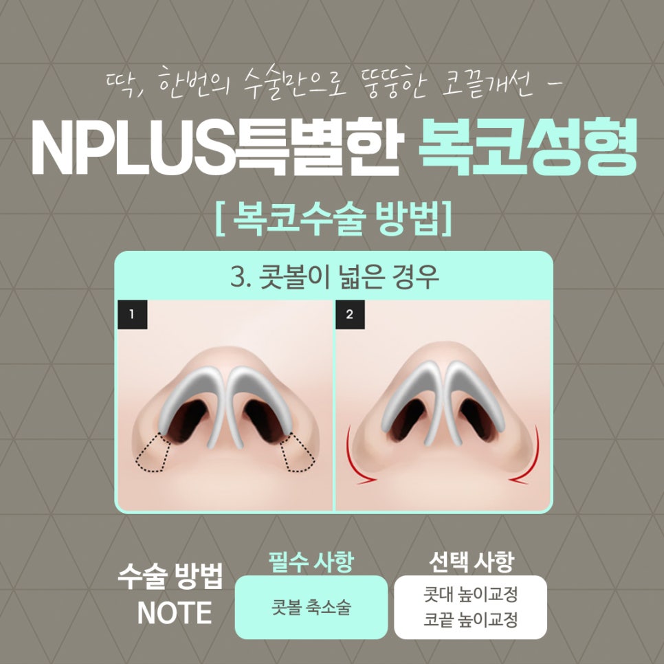 복코수술후기를  확인하고 세련된 이미지로 관련 이미지 11