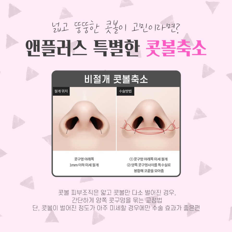 If You Want to Learn About Nostril Reduction Reviews image 6