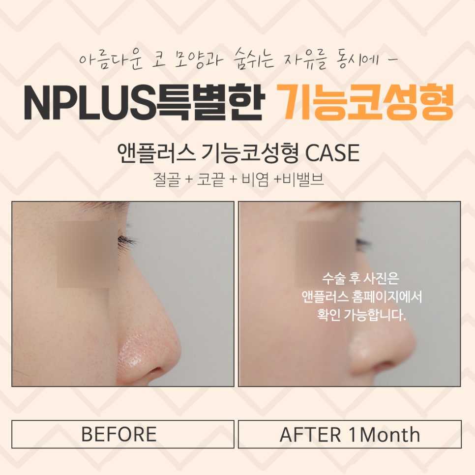Making a Careful Decision After Researching an ENT Clinic for Rhinoplasty image 15