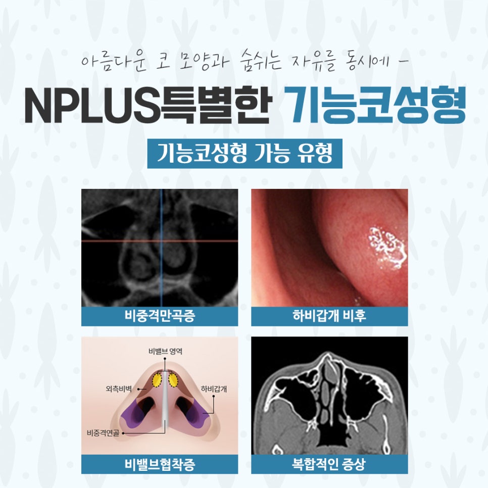 기능코수술후기에 대해 다양하게 알아보고 관련 이미지 5