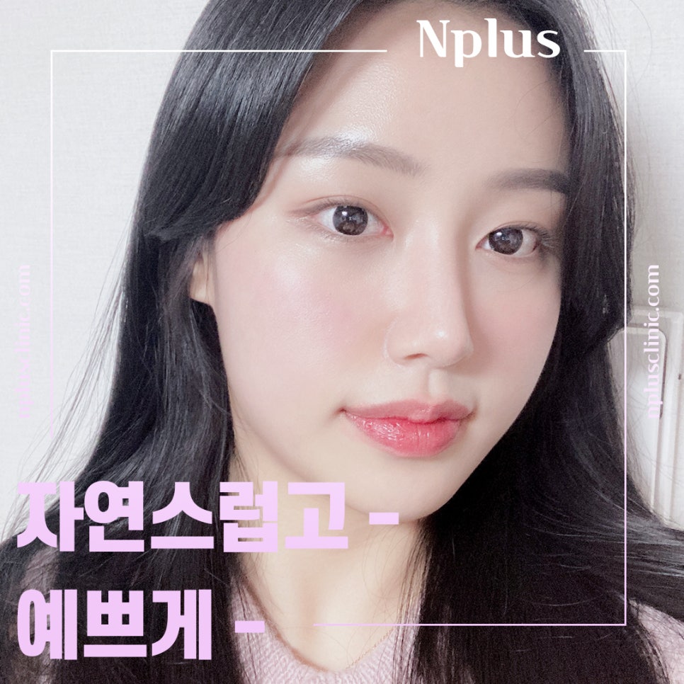 복코수술후기 날렵하고 세련된 라인으로 관련 이미지 12