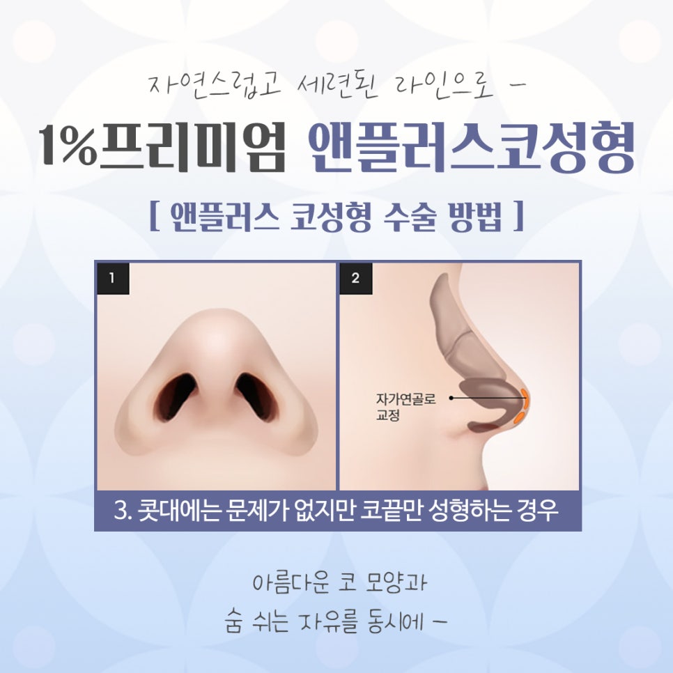 늑연골코성형을 고민한다면 관련 이미지 9