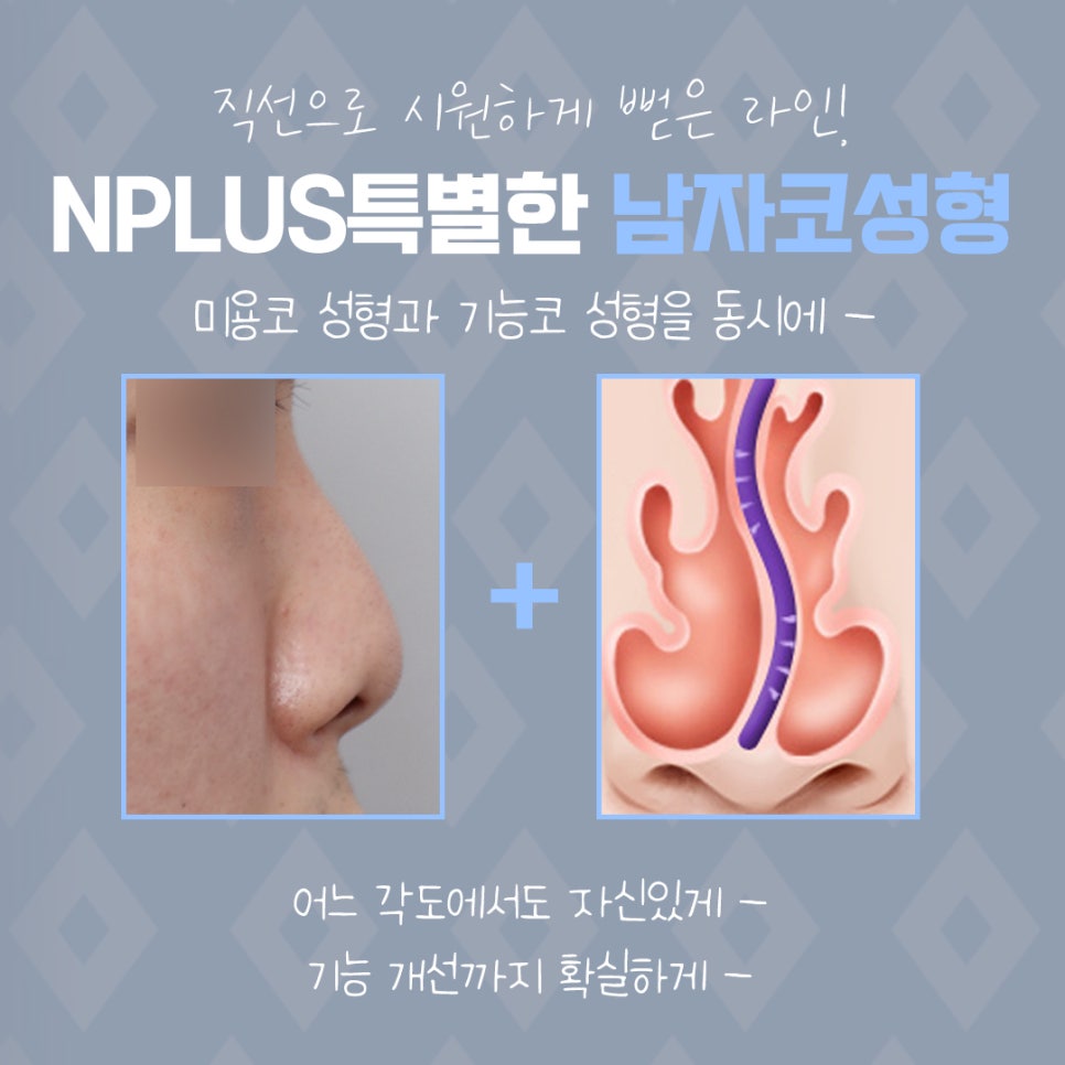 Male Nose Surgery Review: You Should Also Look into Function image 5