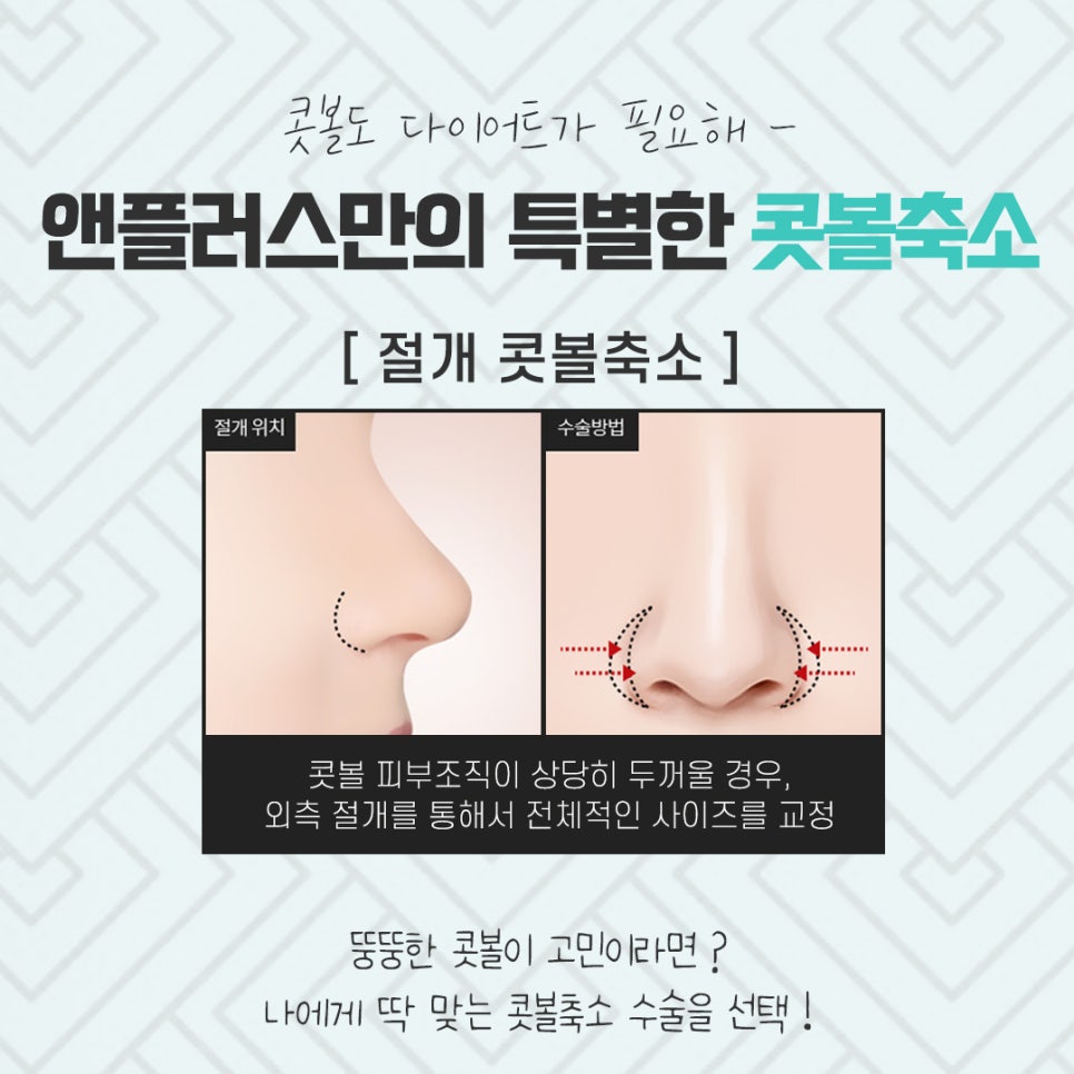 콧볼축소수술후기의 차이를 비교해 보고 관련 이미지 9