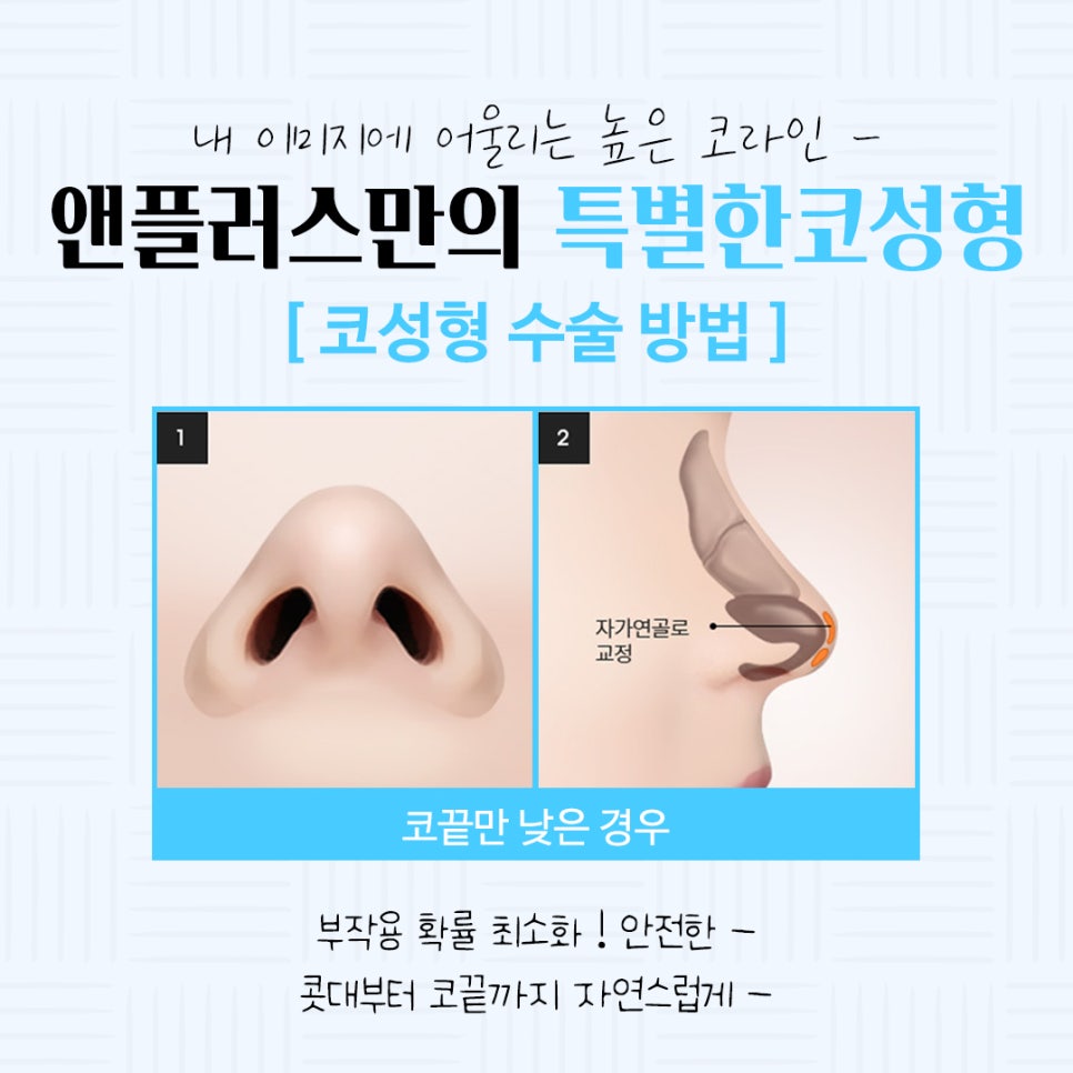 Learn About Autologous Cartilage Rhinoplasty image 8