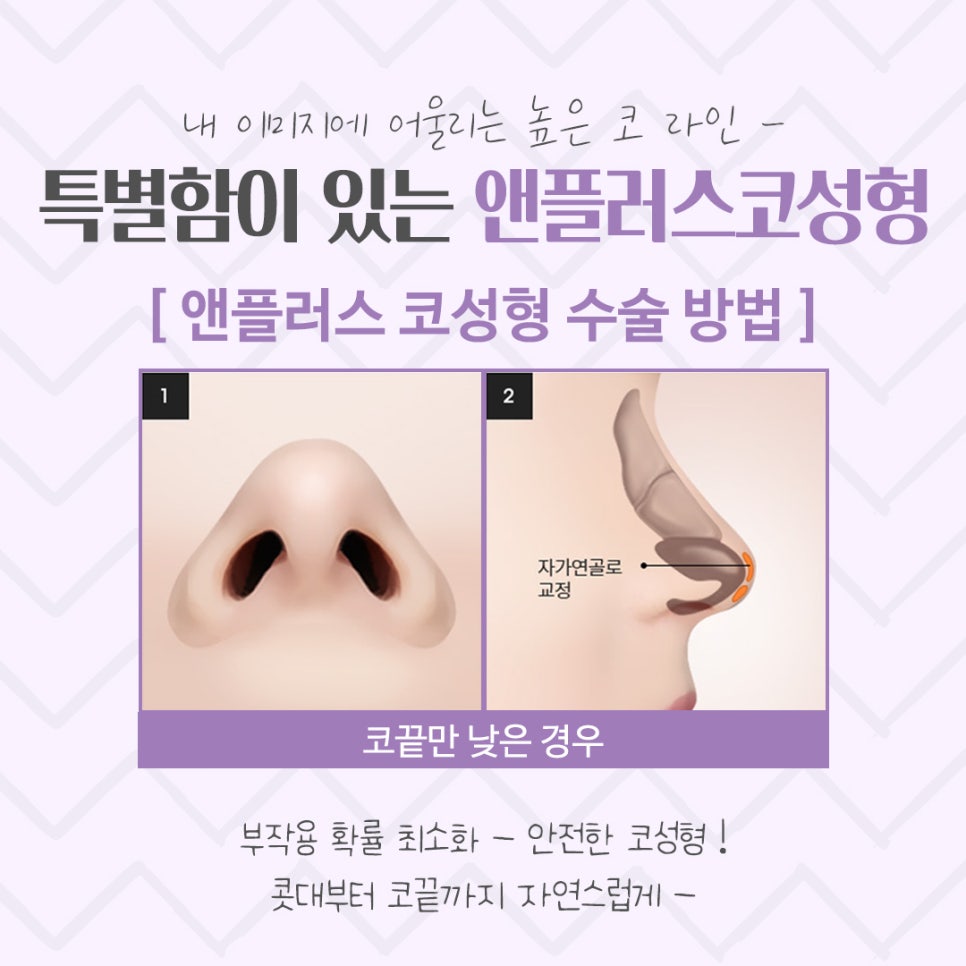 코수술후기를 통해 내게 어울리는 라인으로 관련 이미지 9