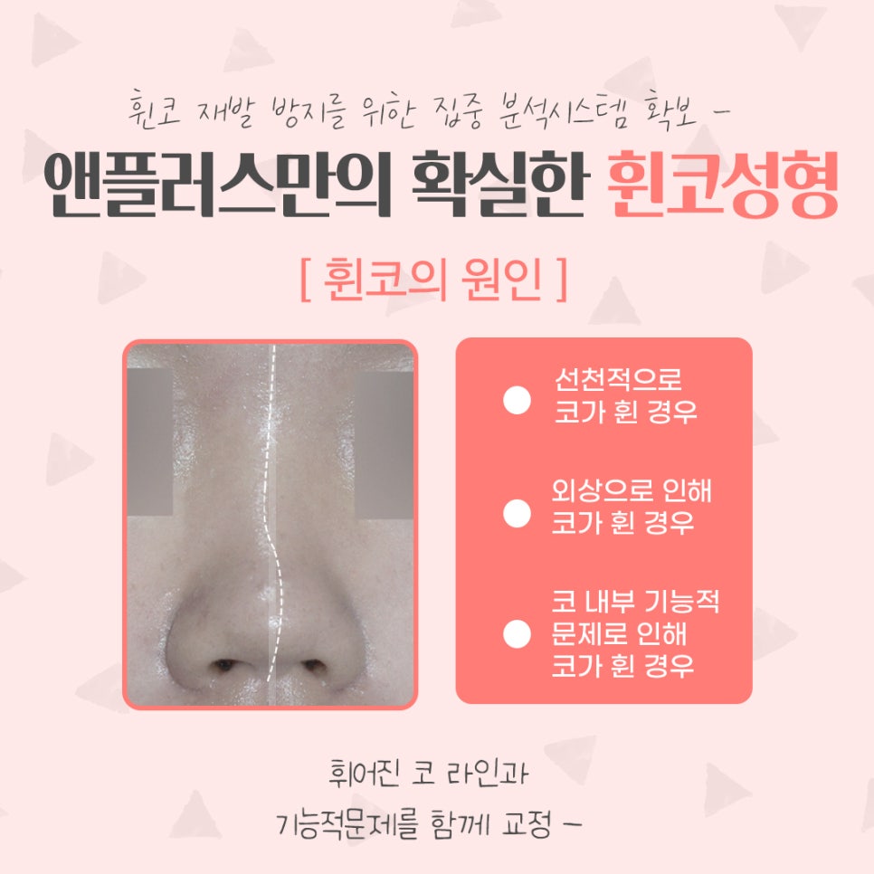 휜코수술후기 정확한 진단을 통해 관련 이미지 4
