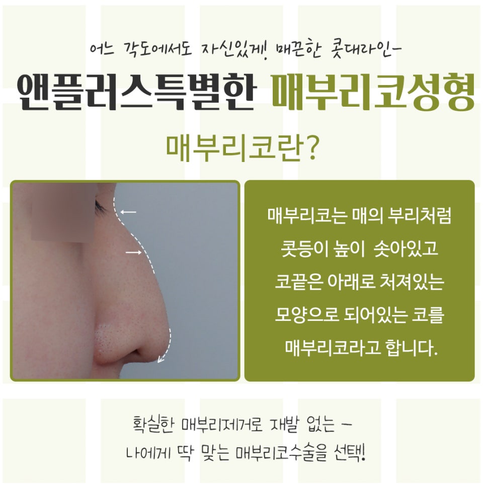매부리코성형후기 정확한 진단을 통해 관련 이미지 3