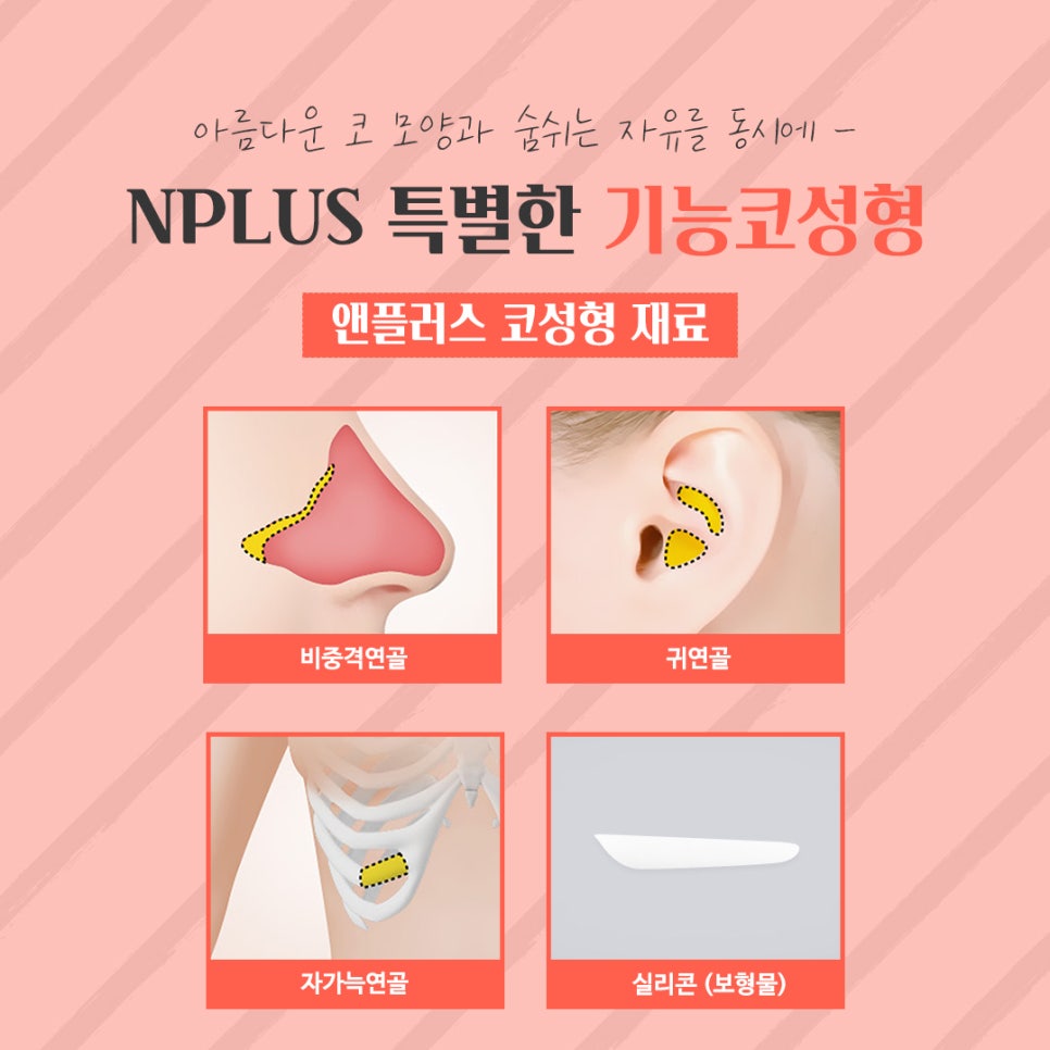 Female Rhinoplasty Review: A Line That Suits You image 9