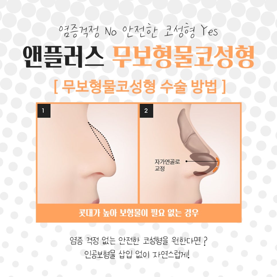 Sophisticated and Natural with Non-Implant Nose Surgery image 8