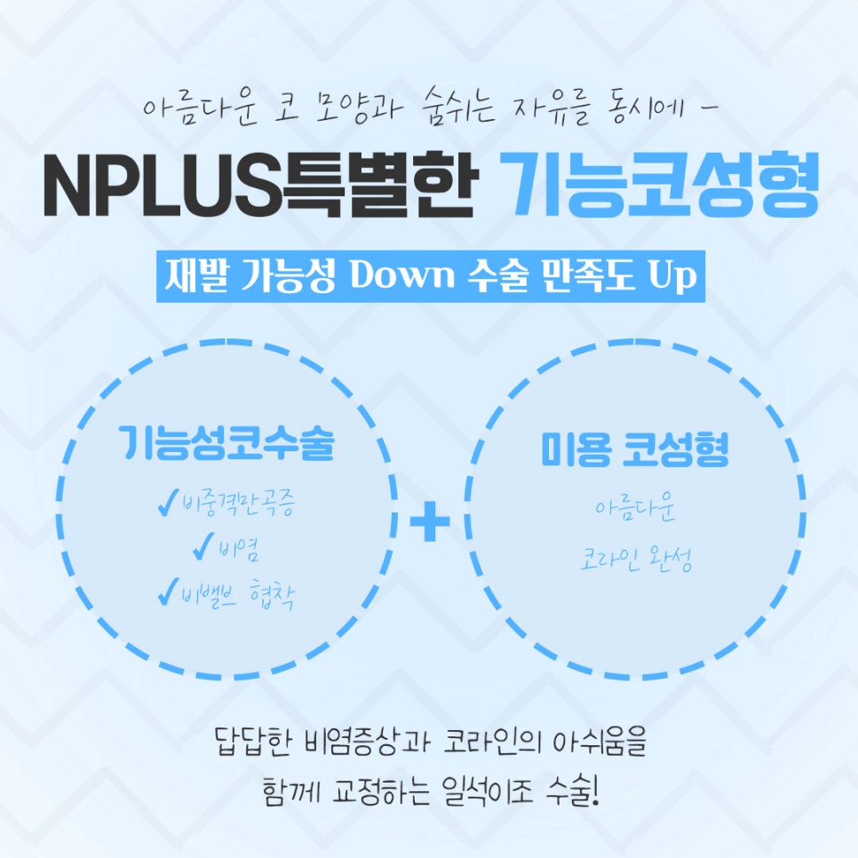 기능코성형후기를 신중하게 알아보고 관련 이미지 3