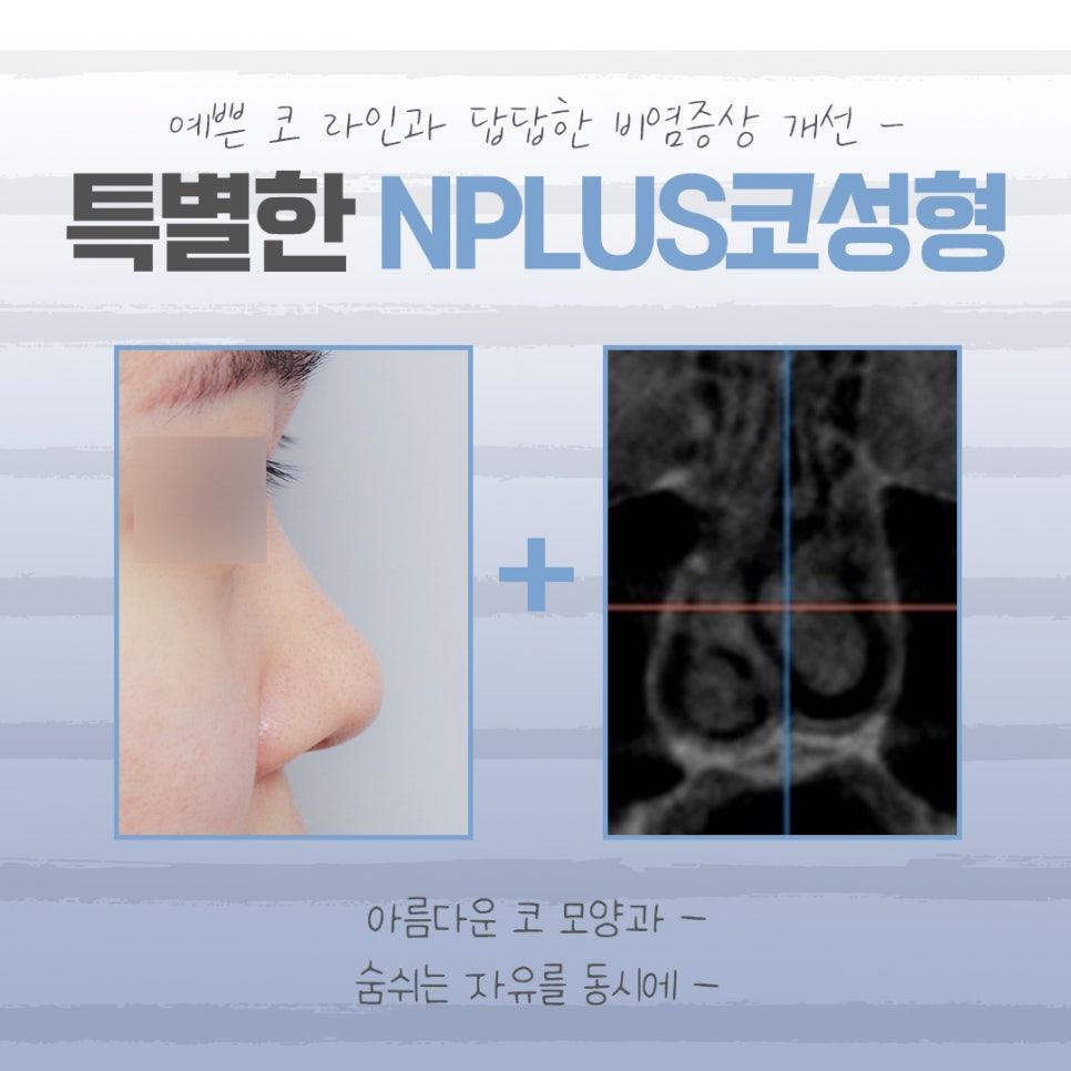 낮은코성형에 대해 꼼꼼하게 체크하고 관련 이미지 3