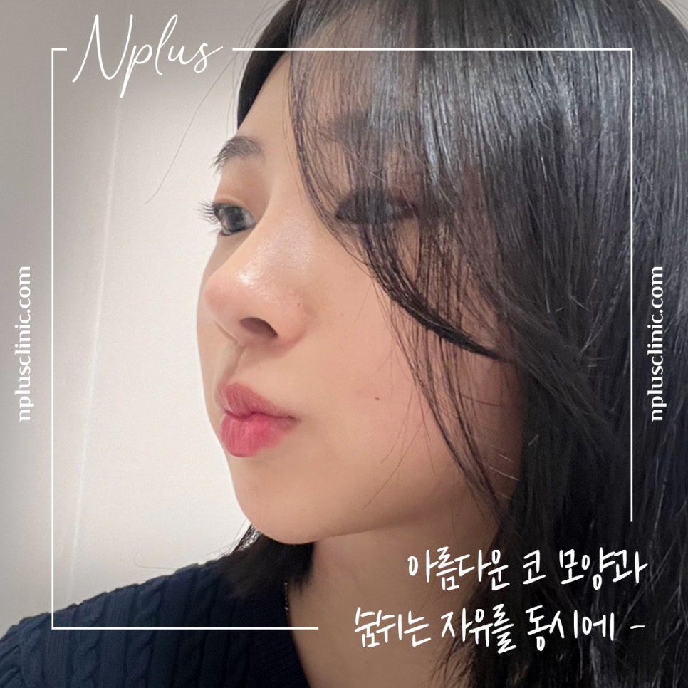 긴코수술을 통해 동안으로 관련 이미지 5