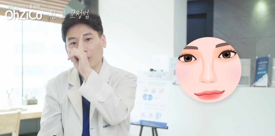 코성형 하면 예쁜코와 효과 없는 코! 관련 이미지 17