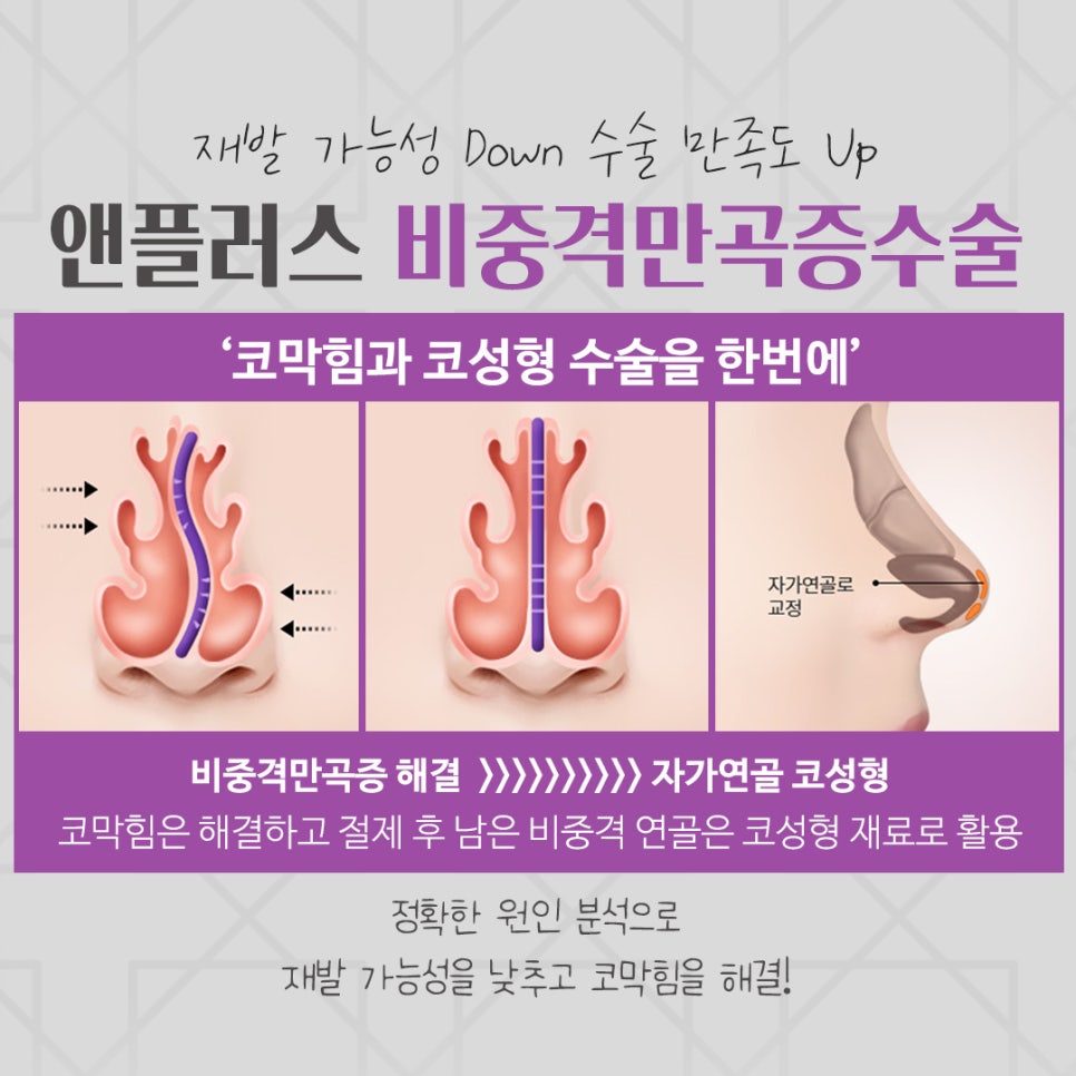 비중격만곡증수술 원인을 자세하게 관련 이미지 8