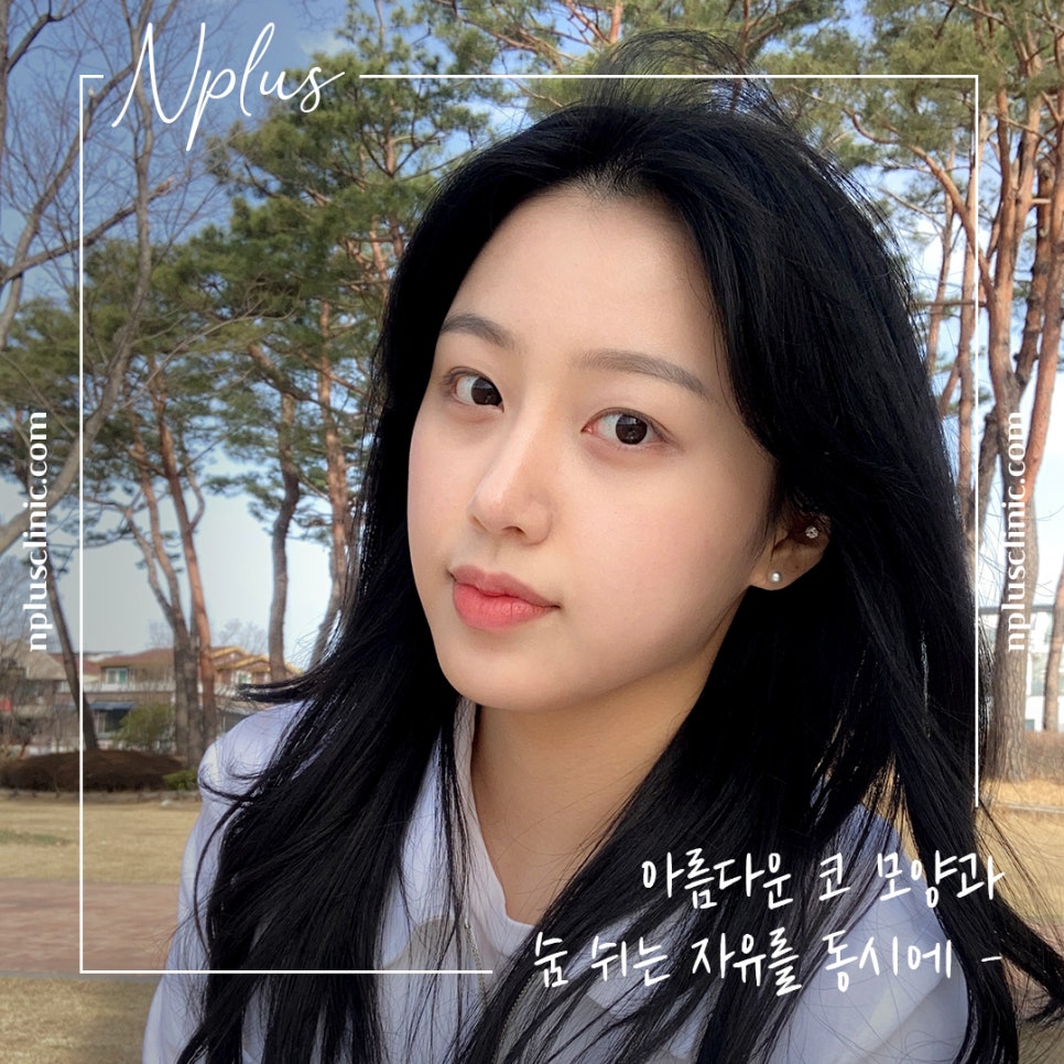 자가늑코수술에 대해 자세히 찾아보고 관련 이미지 7