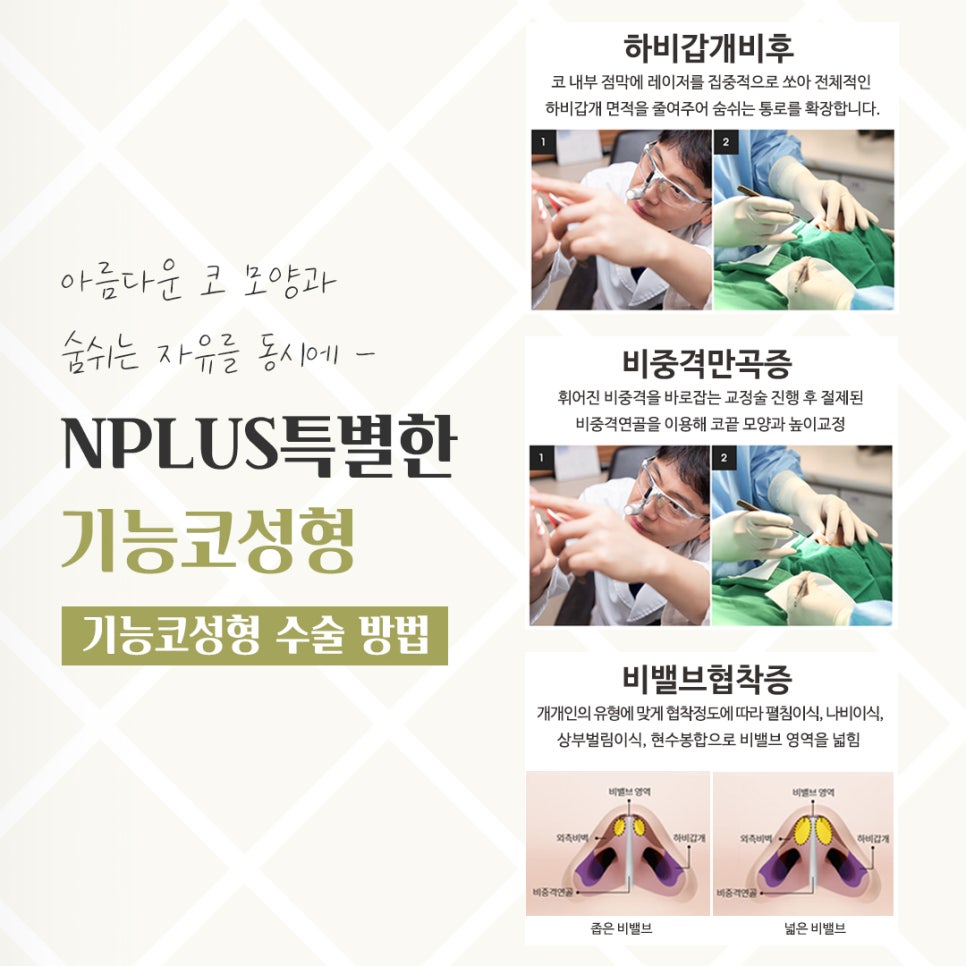 Detailed Information on Functional Rhinoplasty Reviews image 9
