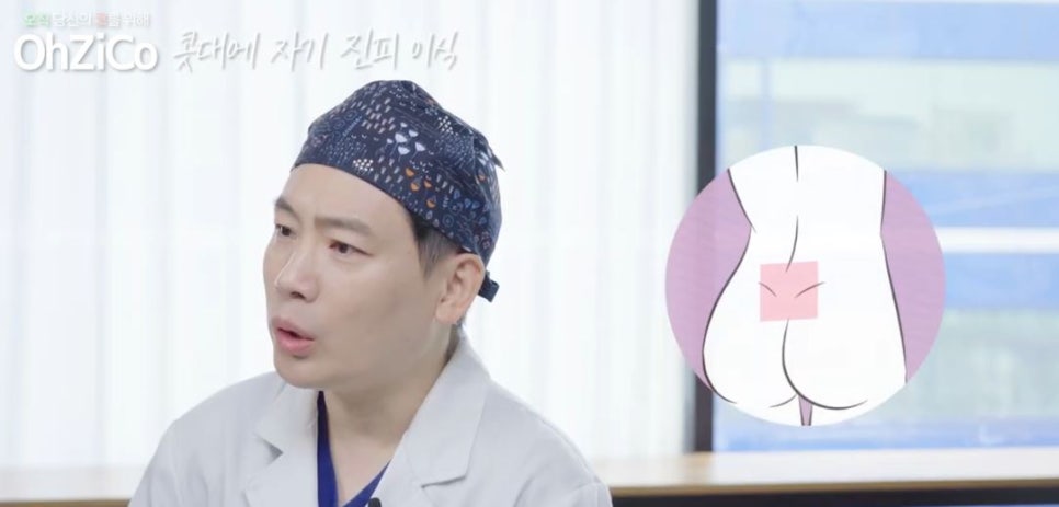 콧대성형에 사용되는 자가보형물 관련 이미지 4