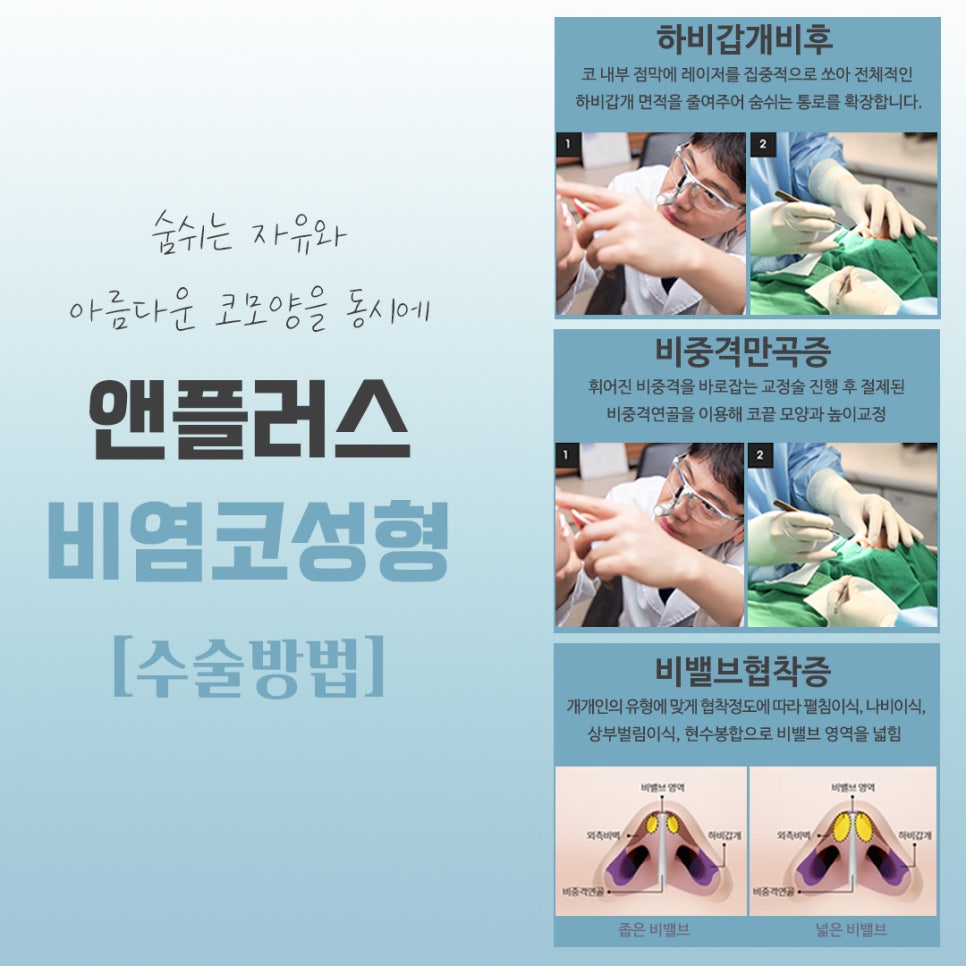 비염코수술전후에 대해 자세히 알아보고 관련 이미지 7