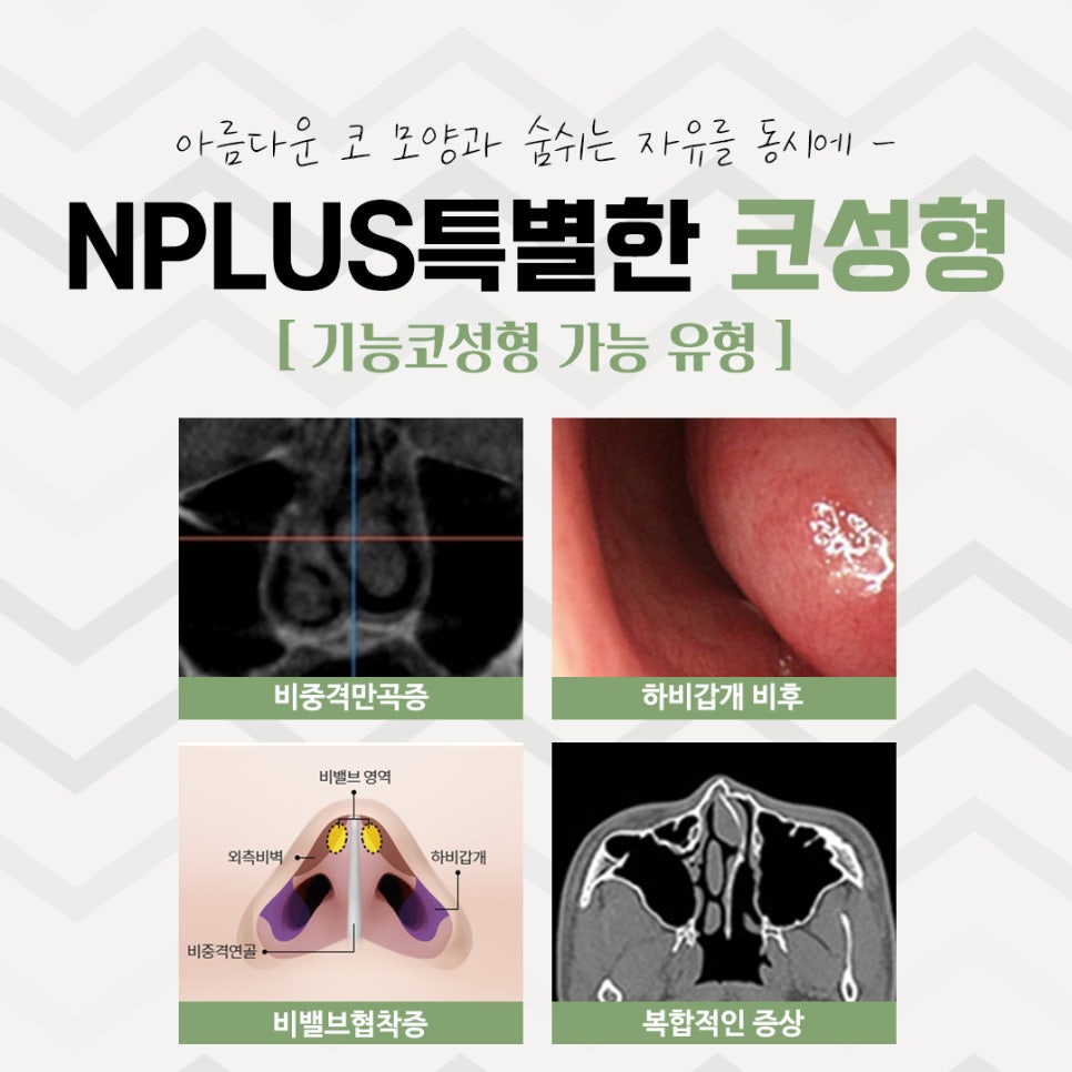 코수술전후 확실한 차이를 알아보고 관련 이미지 4