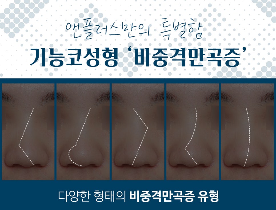 Septoplasty for Satisfying Results image 5
