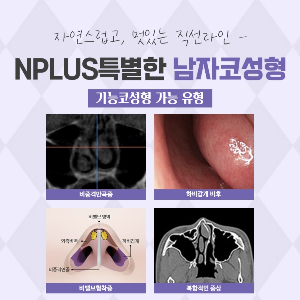 남자성형 자연스럽고 멋있게 관련 이미지 5