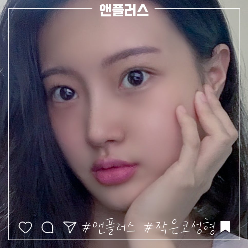작은코수술 오지코병원에서 확실하게 확인해 보고 관련 이미지 2
