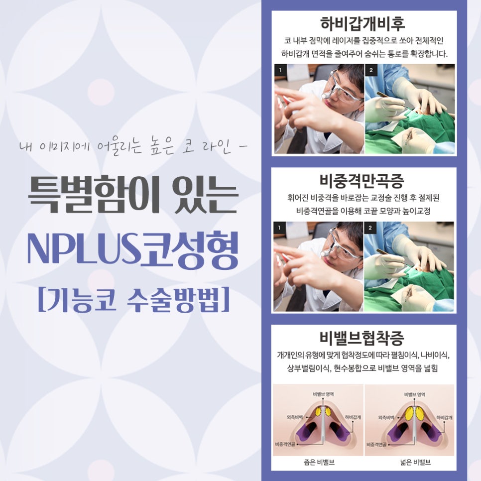 코성형잘하는곳에서 자연스럽고 예쁘게 관련 이미지 11